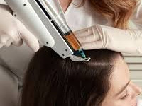 Mesotherapy Treatment2